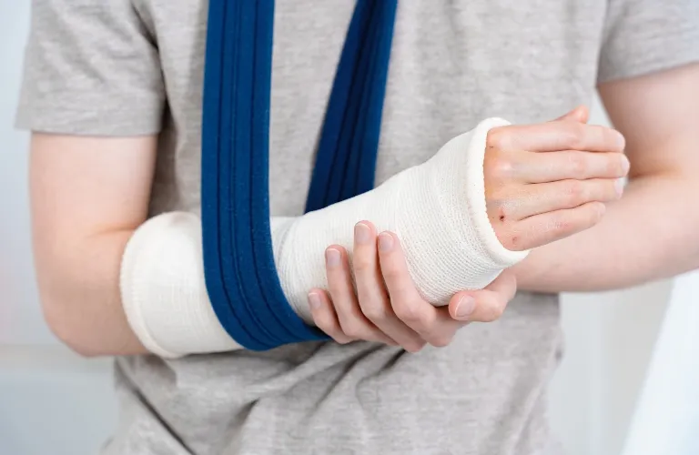 Close-up of a person wearing a gray shirt with a white arm cast supported by a blue sling.